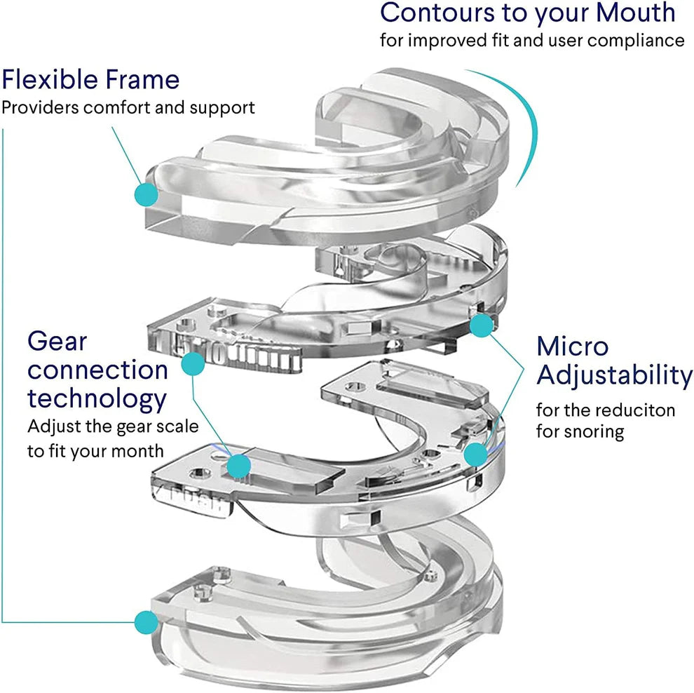 NoctiGuard - Anti-Snoring Mouth Guard