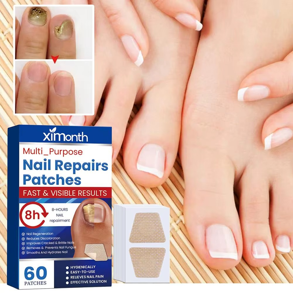 Fungus Repair Patches