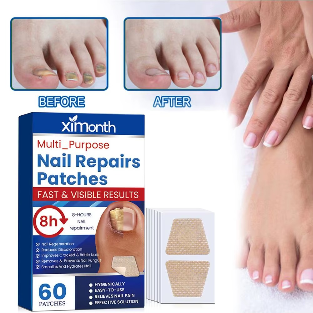 Fungus Repair Patches