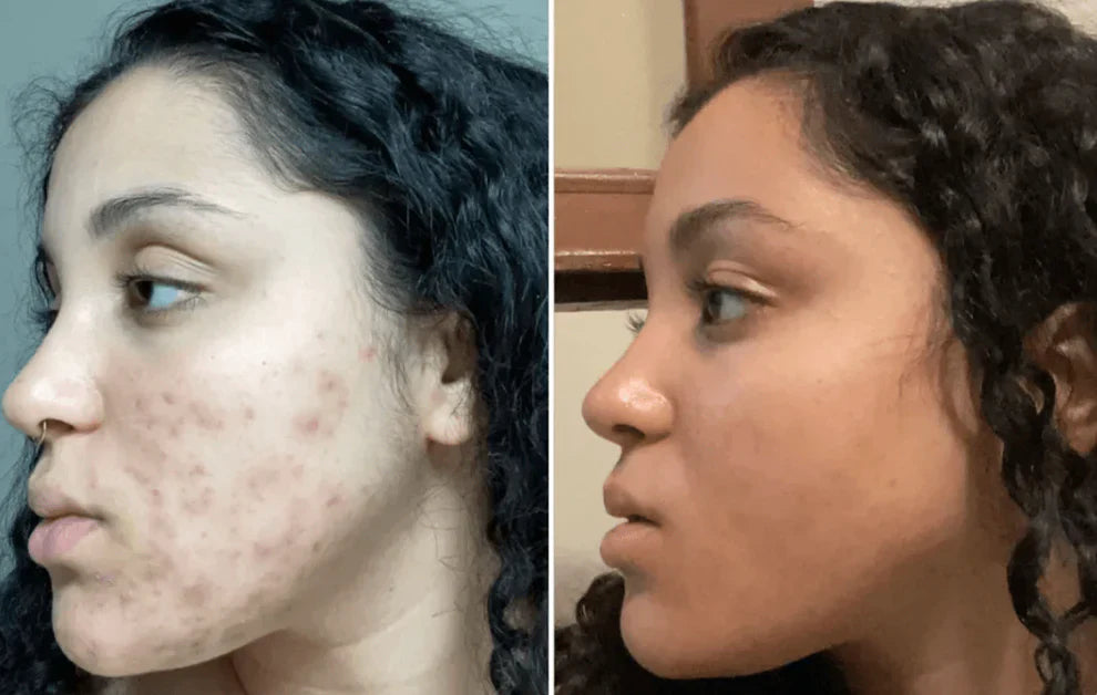 Bio Collagen Mask - Buy 1 Get 1 FREE