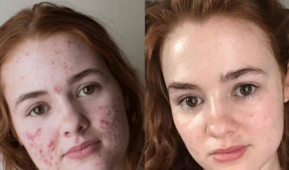 Bio Collagen Mask - Buy 1 Get 1 FREE