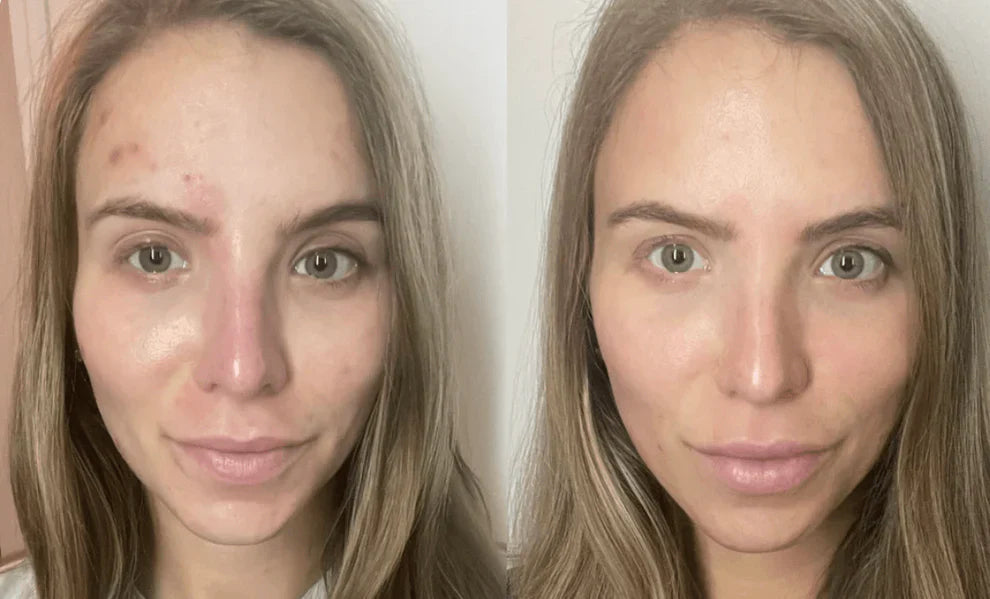 Bio Collagen Mask - Buy 1 Get 1 FREE