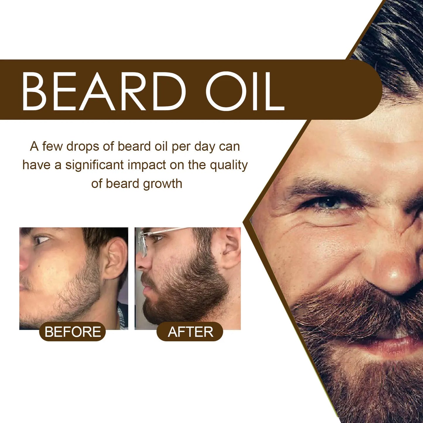 East Moon Beard Growth & Treatment Oil