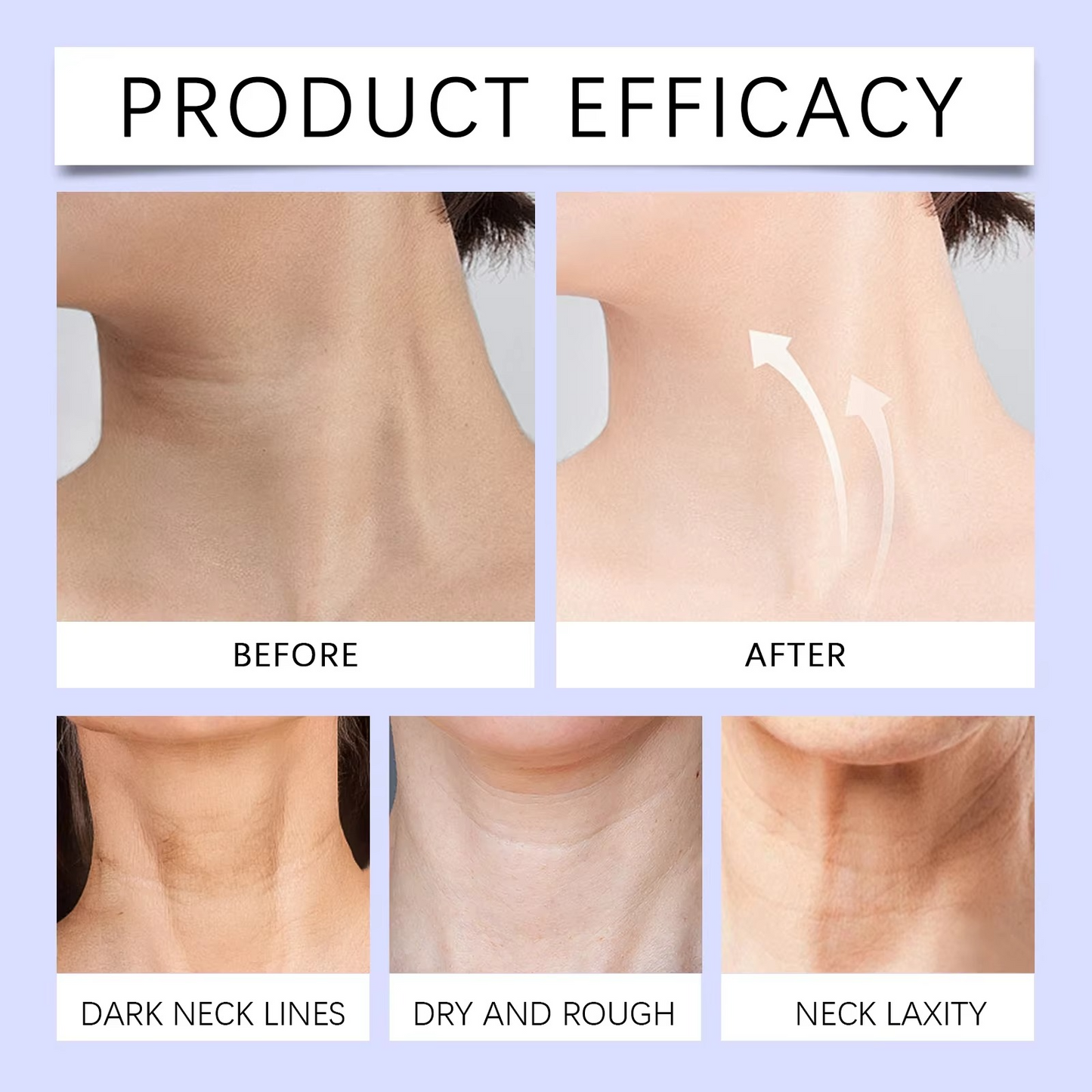 Neck Lift Cream