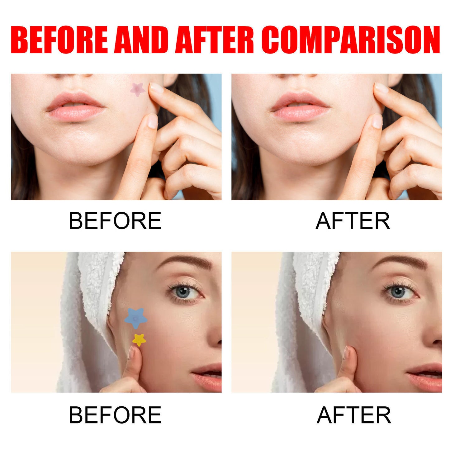 Pimples Patch
