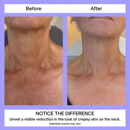 Neck Lift Cream