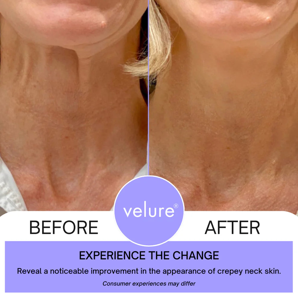 Neck Lift Cream