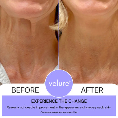 Neck Lift Cream