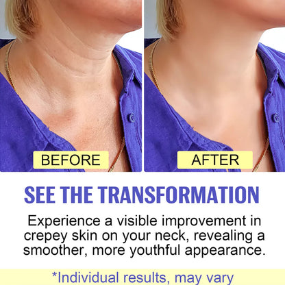 Neck Lift Cream