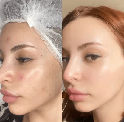 Bio Collagen Mask - Buy 1 Get 1 FREE
