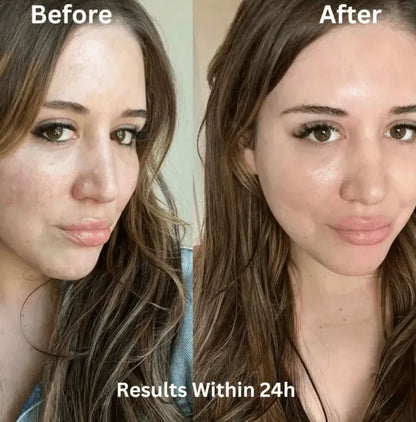 Bio Collagen Mask - Buy 1 Get 1 FREE