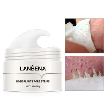 Black head remover