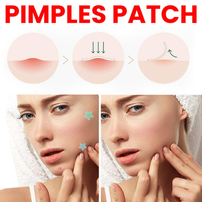 Pimples Patch