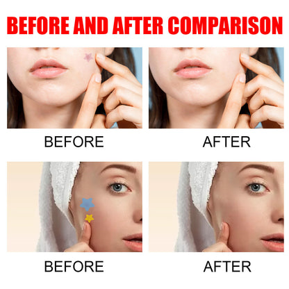 Pimples Patch